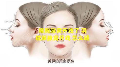 隆胸腋窝开线了 羽绒服腋窝开线 怎么缝